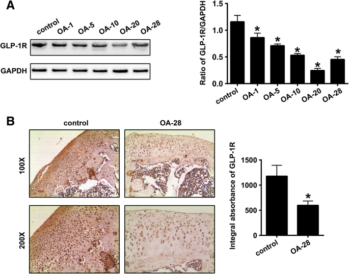 does glp 1 cause blindness GLP-1s not tied to higher risk for form of optic neuropathy that may cause  blindness