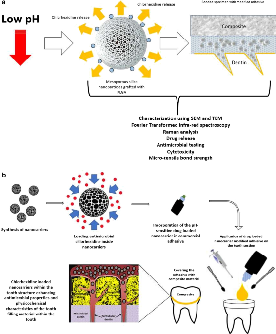 pH-dependent delivery of chlorhexidine from PGA grafted mesoporous silica nanoparticles at resin-dentin interface | Journal of Nanobiotechnology | Springer Nature Link pH-dependent delivery of chlorhexidine from PGA grafted mesoporous silica nanoparticles at resin-dentin interface | Journal of Nanobiotechnology | Springer Nature Link