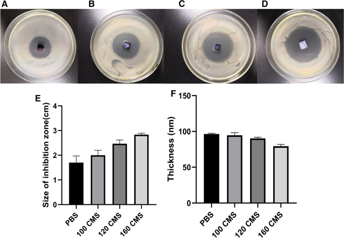 Frontiers  Antibacterial intraosseous implant surface coating