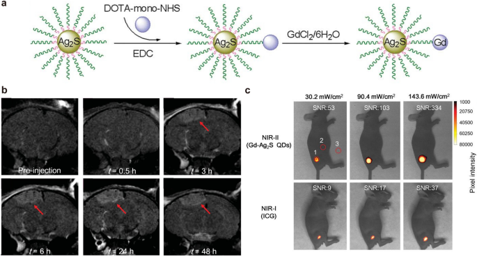 A pH-responsive T1-T2 dual-modal MRI contrast agent for cancer imaging