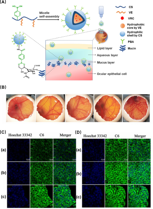 Engineered vector evades photoreceptor pathology and microglia and CD8