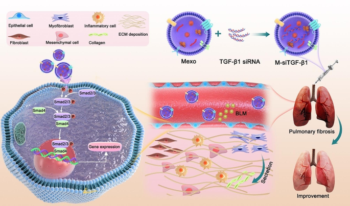 Nebulized milk exosomes loaded with siTGF-β1 ameliorate pulmonary fibrosis by inhibiting EMT pathway and enhancing collagen permeability | Journal of Nanobiotechnology