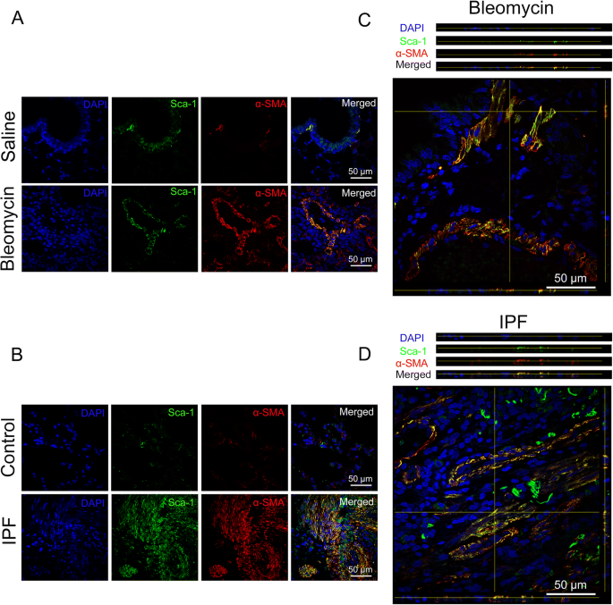 bpc-157 macrophage m1 to m2 shift In Vitro Differentiation of Human PBMC Derived Monocytes into or Macrophages in a Serum-free and Xeno-free Cell Culture Media M2 macrophages promote myofibroblast differentiation