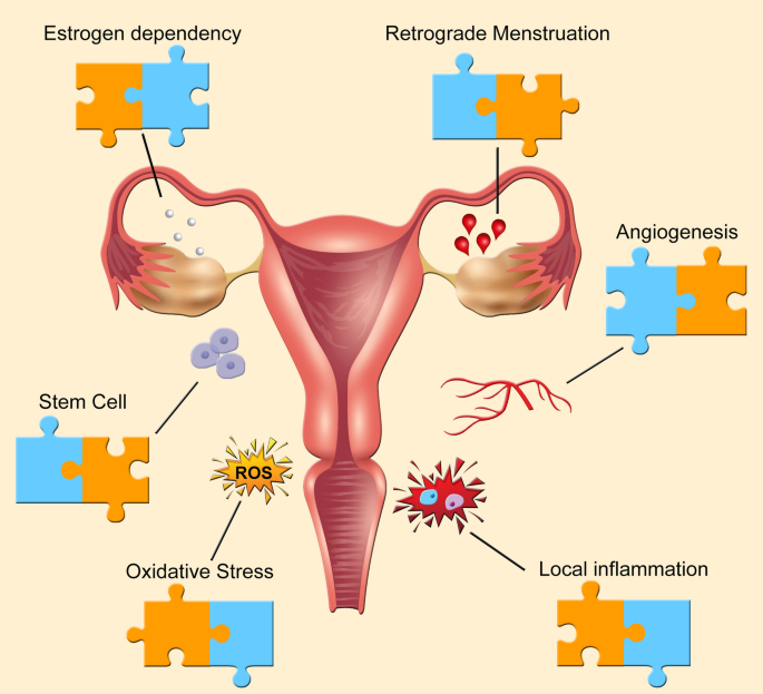 Man v Endometriosis #periodpainsimulator #endo #endometriosis