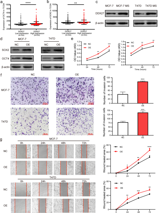 DEAD-box helicase 27 enhances stem cell-like properties with poor prognosis in  breast cancer, Journal of Translational Medicine