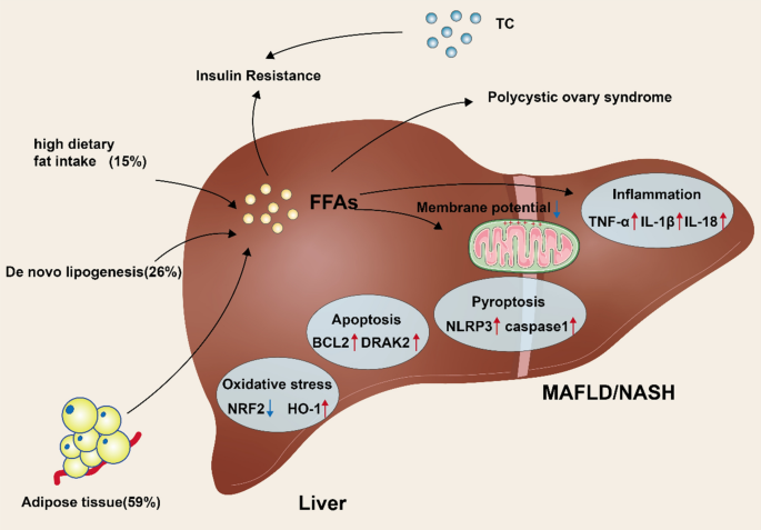l-glutathione for fatty liver Mitochondrial metabolic dysfunction and non-alcoholic fatty liver disease:  new insights from pathogenic mechanisms to clinically targeted therapy |  Journal of Translational Medicine