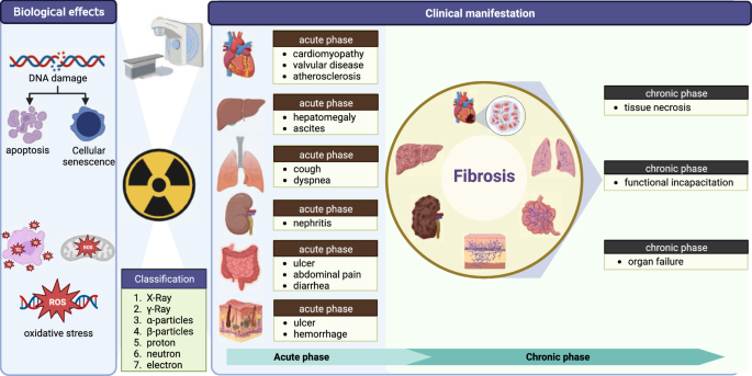 Tissue fibrosis induced by radiotherapy: current understanding of the  molecular mechanisms, diagnosis and therapeutic advances | Journal of  Translational Medicine | Springer Nature Link