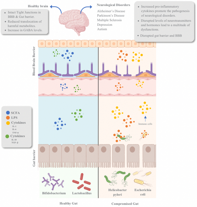 Beyond weight loss: exploring the neurological ramifications of altered gut microbiota post-bariatric surgery | Journal of Translational Medicine | Springer Nature Link Beyond weight loss: exploring the neurological ramifications of altered gut microbiota post-bariatric surgery | Journal of Translational Medicine | Springer Nature Link