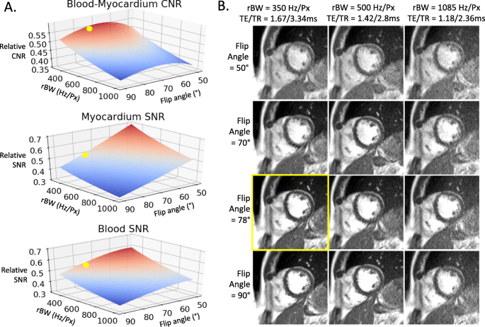 Journal of Magnetic Resonance Imaging: Vol 55, No 1