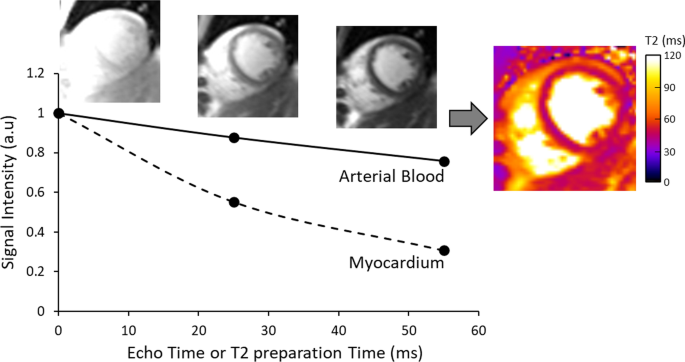 T2 Relaxation Times at Cardiac MRI in Healthy Adults: A Systematic