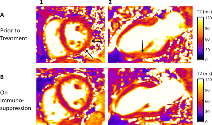 T2 map image before (a) injection and (b) 2:30 h post-injection of