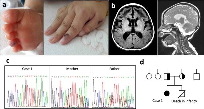 l carnitine lupus Characteristics and genetic analysis of patients suspected with early-onset systemic erythematosus | Pediatric Rheumatology Routines and kits Variant:1mg L-Carnitine 500mg Bodybuilding Energy-Chronic