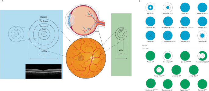 Altered ocular microvasculature in patients with systemic sclerosis and  very early disease of systemic sclerosis using optical coherence tomography  angiography