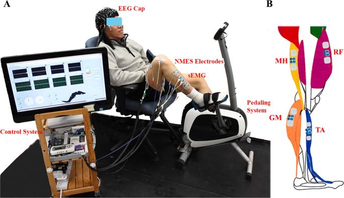 Pathway-specific modulatory effects of neuromuscular electrical stimulation  during pedaling in chronic stroke survivors, Journal of NeuroEngineering  and Rehabilitation