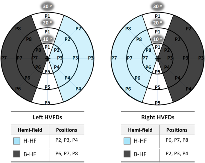 Visual processing speed in hemianopia patients secondary to acquired brain  injury: a new assessment methodology, Journal of NeuroEngineering and  Rehabilitation