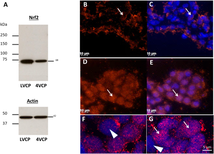 The glutathione-dependent neuroprotective activity of the blood-CSF barrier  is inducible through the Nrf2 signaling pathway during postnatal  development | Fluids and Barriers of the CNS | Springer Nature Link