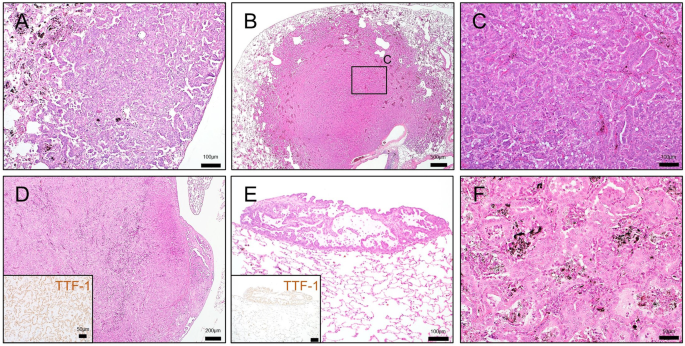 A) Microphotograph of HCPT-MVLs at × 400 magnification; (B) size