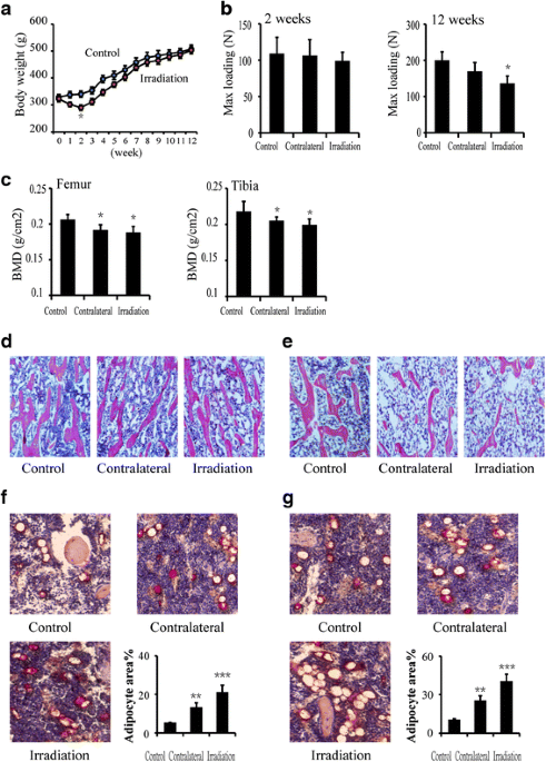 In Vivo High-Resolution Bioimaging of Bone Marrow and Fracture