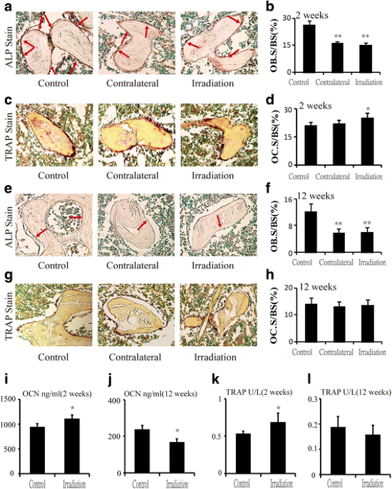 In Vivo High-Resolution Bioimaging of Bone Marrow and Fracture