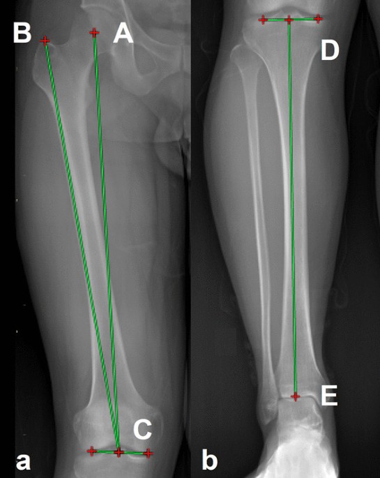 Distribution of sizes at maturity (tibia–patella length = TPL) in