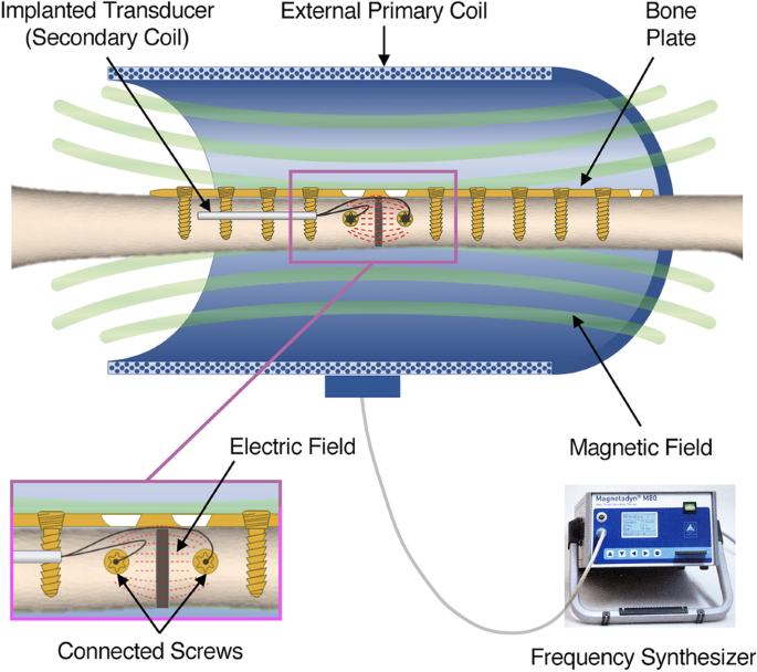 Hip Pain Treatment using Magnetic Therapy by Q Magnets