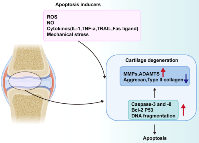 Mechanisms of chondrocyte cell death in osteoarthritis: implications for  disease progression and treatment | Journal of Orthopaedic Surgery and  Research | Springer Nature Link