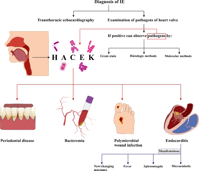 Infective endocarditis by HACEK: a review | Journal of Cardiothoracic  Surgery | Full Text