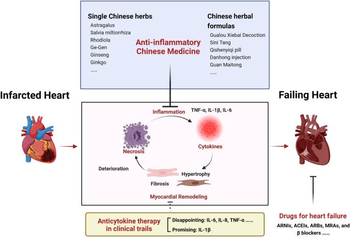 Chinese herbal medicine may improve outcomes after STEMI