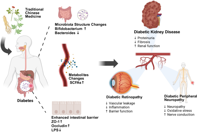 Regulatory mechanisms of Traditional Chinese Medicine on gut microbiota in diabetic microvascular complications | Chinese Medicine