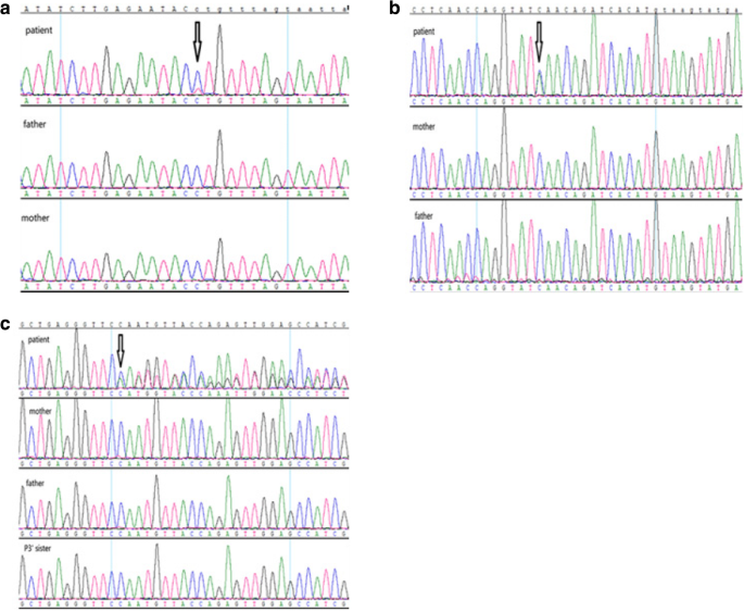 High frequency of copy number imbalances in Rubinstein–Taybi patients  negative to CREBBP mutational analysis