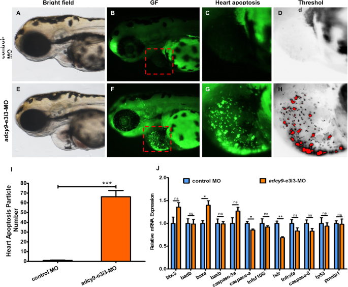 Ultra-Rare Syndromes: The Example of Rubinstein-Taybi Syndrome