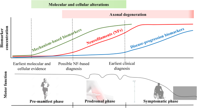 NfL as a biomarker for neurodegeneration and survival in Parkinson