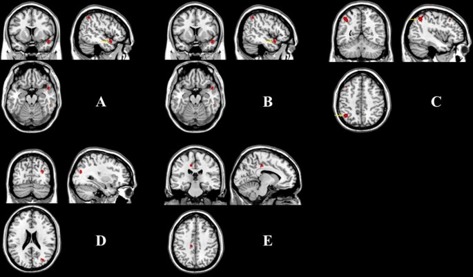 Results of whole brain analyses in the test scan. a The left parietal