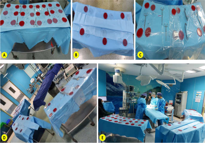 The safety of a novel single-drape cover for sterile back tables in the operating  room compared to the standard two-drape method: an experimental study, Patient Safety in Surgery