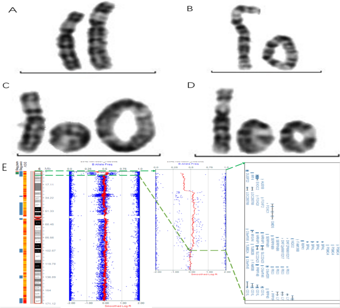 PDF) Molecular cytogenetic and phenotypic characterization of ring  chromosome 13 in three unrelated patients