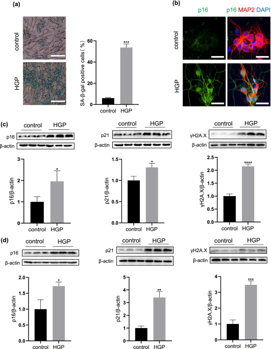 High glucose and palmitic acid induces neuronal senescence by NRSF/REST elevation and the subsequent mTOR-related autophagy suppression