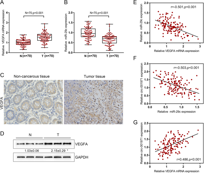 PDF) Abstract A74: Microparticles mediate cross-talk between tumoral and  endothelial cells and promote the constitution of an angiocrine  pro-metastatic niche through Arf6 up regulation