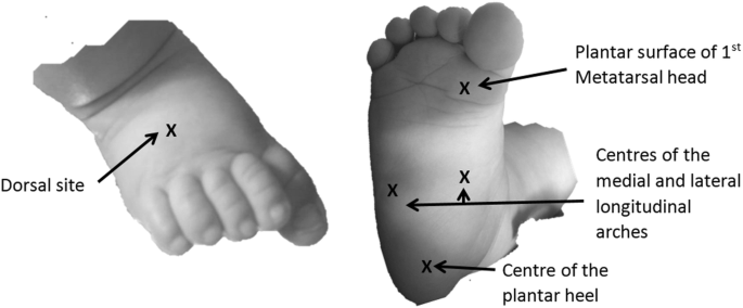 Baby's Feet – Development, Problems and Foot Care