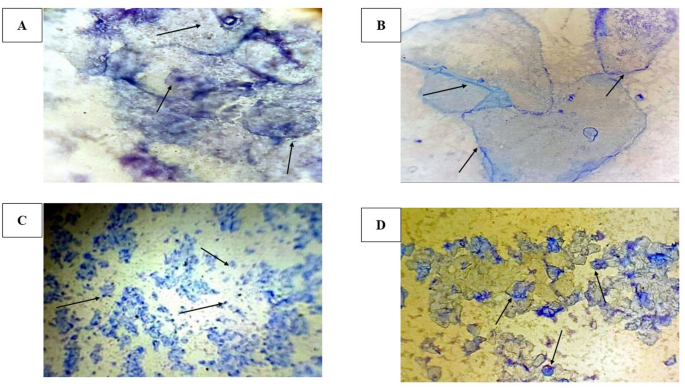 pcos glutathione The effect of aqueous Stevia rebaudiana extract and clomiphene citrate on the expression of GDF9, PTEN, BMP15 genes, and antioxidant levels in a letrozole-induced polycystic ovary syndrome model in Wistar rats Type:Capsule Sigma-Aldrich Glutathione Reductase human, facewash