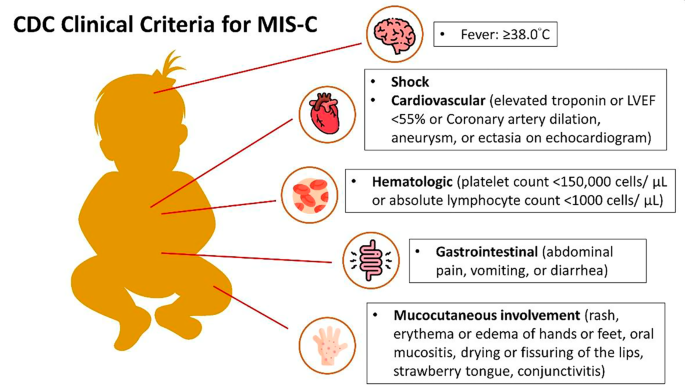 mis c lips New insight into the intravenous immunoglobulin treatment in Multisystem  Inflammatory Syndrome in children and adults | Italian Journal of  Pediatrics