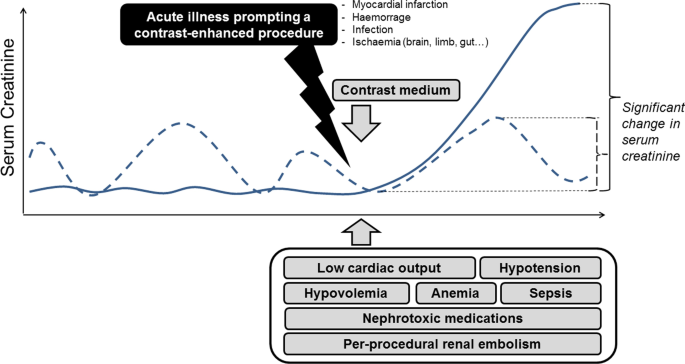 Iodinated contrast medium: Is there a re(n)al problem? A clinical  vignette-based review, Critical Care