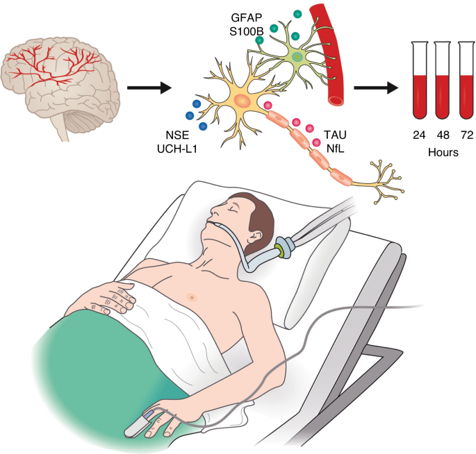 Assessment of neuroendocrine dysfunction following traumatic brain injury.