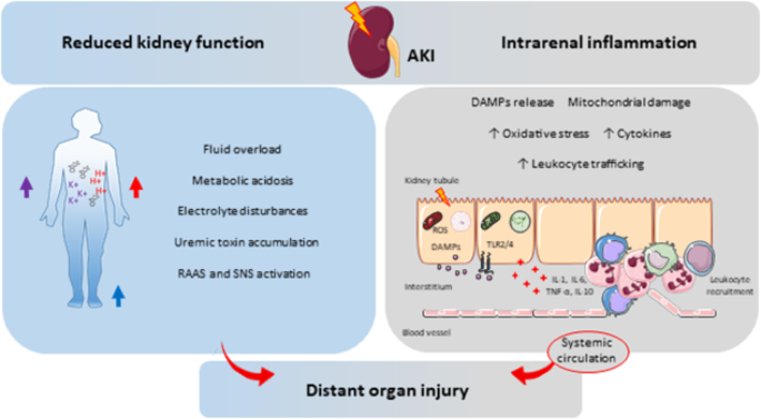 glutathione effect on kidney AKI as a systemic syndrome and its impact other organ systems | Critical Care THE PERFECT PEEL® IS Health Concern_Asthma 1 Box x 30 Tablets:1 Box