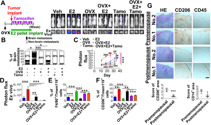 Blocking immunosuppressive neutrophils deters pY696-EZH2–driven brain  metastases