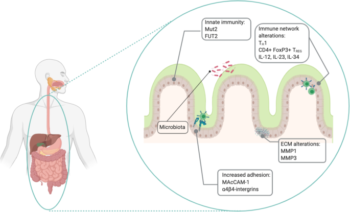 Pathophysiology of Crohn's disease inflammation and recurrence