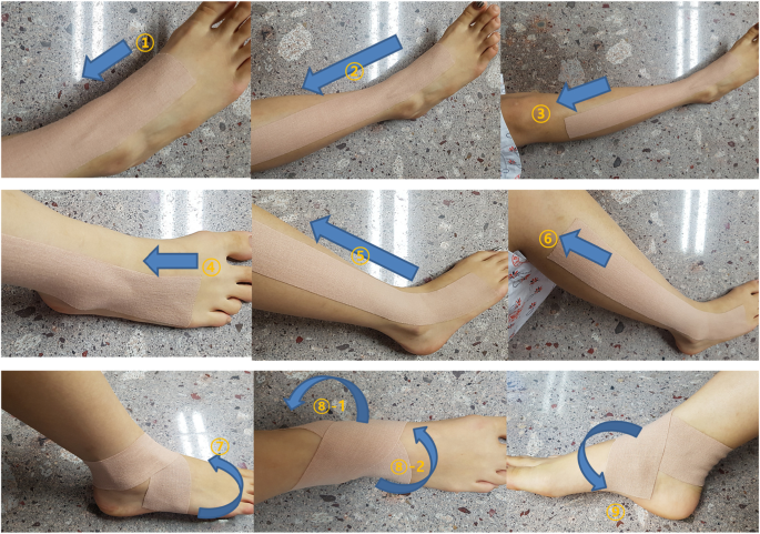 taping for sprain or sprained ankle 