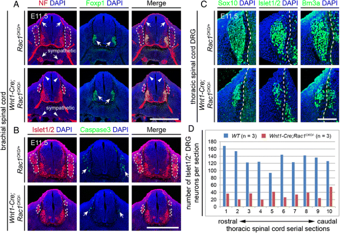 Rac1 Regulates Neuronal Polarization through the WAVE Complex