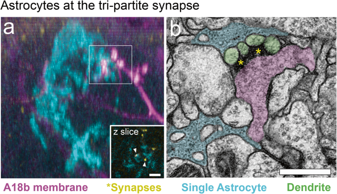 Schematic representation illustrating the astrocyte-synapse alterations