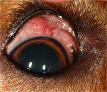 onchocerca volvulus eye
