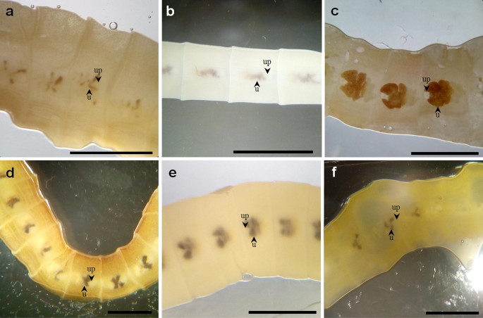 Update on the Human Broad Tapeworm (Genus Diphyllobothrium